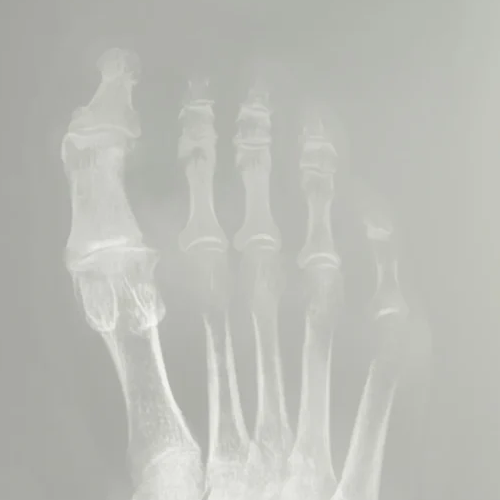 big-toe-arthritis-1024×662 (1) (1) big-toe-arthritis-1024x662 (1) (1)