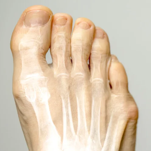 big-toe-arthritis-1024x662 (2) (1)