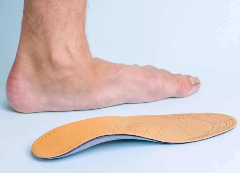 flat-foot-e1729227122942-1024x739 (1)