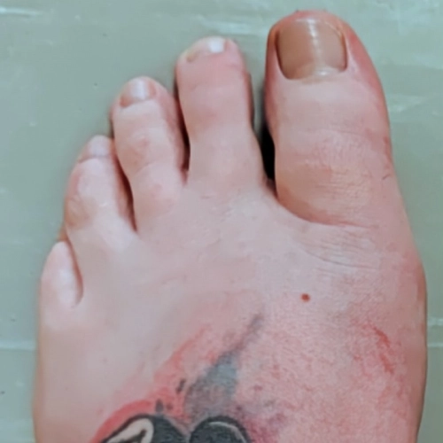 Orthopaedic foot specialist in Cheltenham providing advanced foot pain treatment