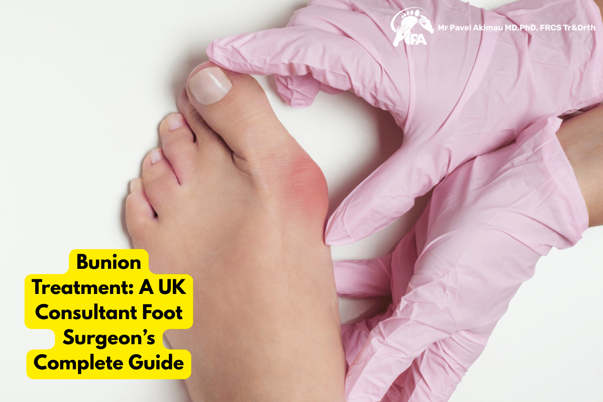 Bunion Treatment: A UK Consultant Foot Surgeon’s Complete Guide